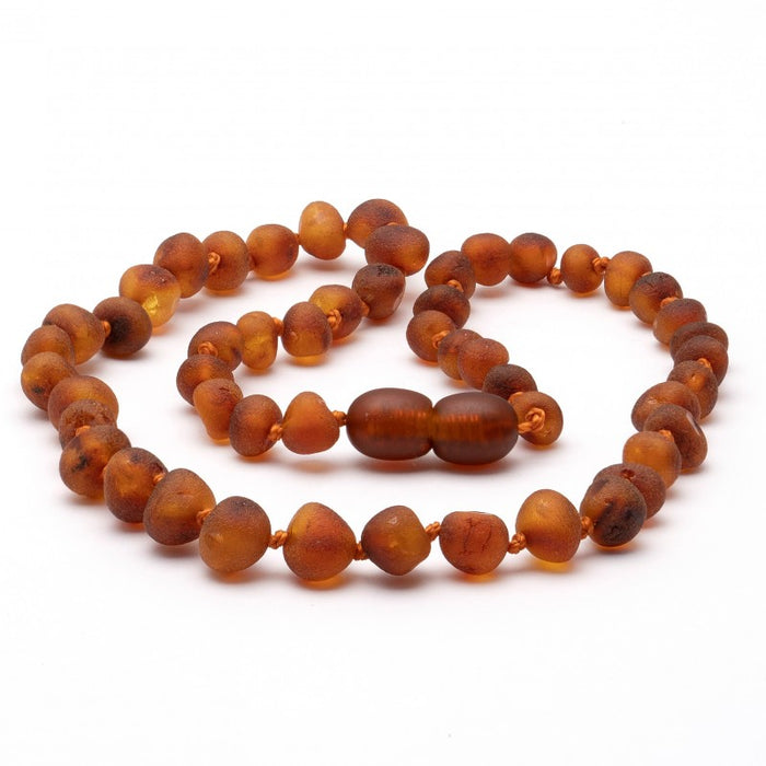 Raw Baltic Amber Necklace