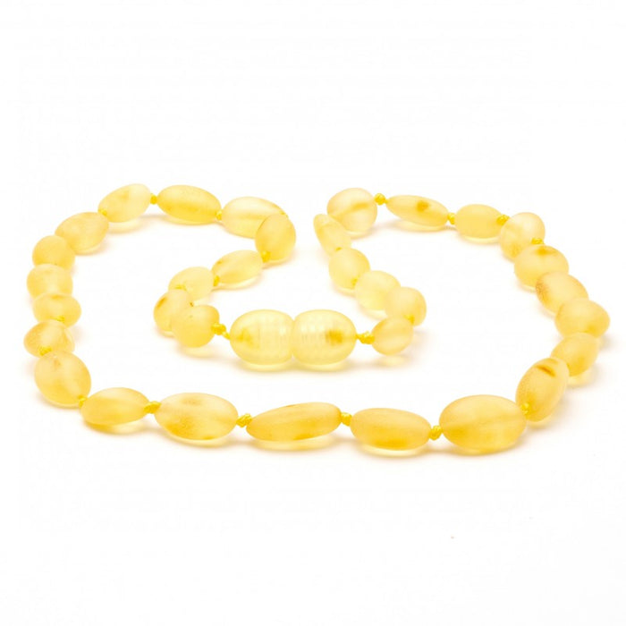 Raw Baltic Amber Necklace